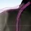 Thumbnail for "Chirurgiens de l'Espoir"